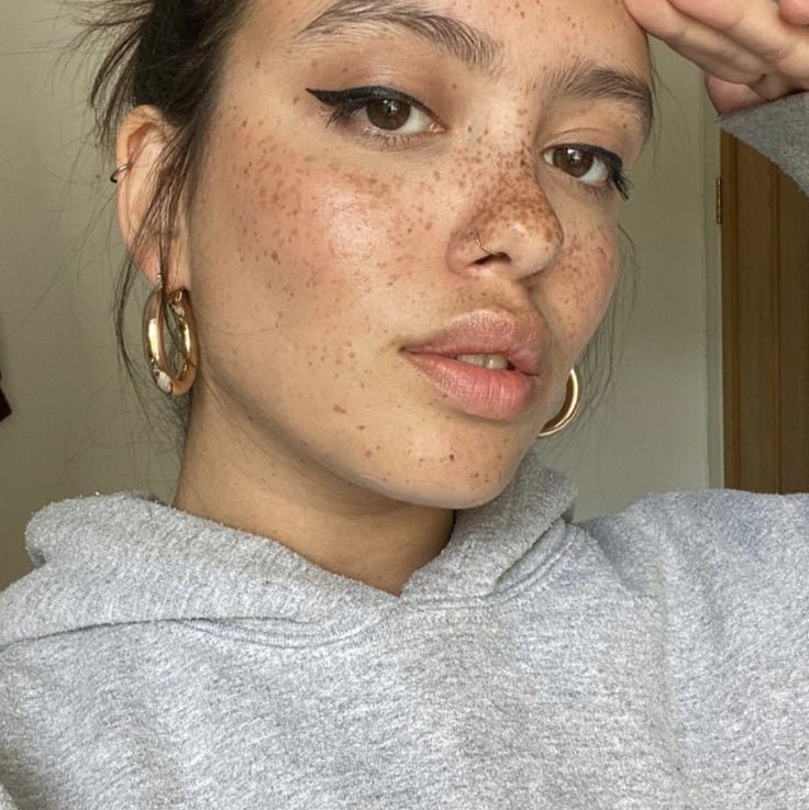 Formation en présentiel : "Tâches de rousseurs" - ACM BEAUTY